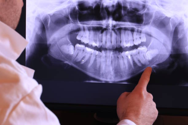 Best Emergency Root Canal Treatment in Creighton, NE