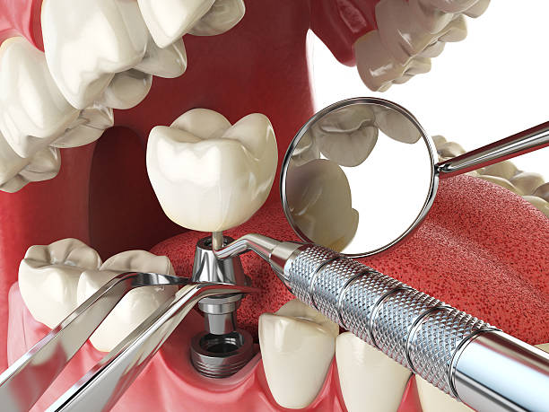 Best Same-Day Emergency Dentist in Creighton, NE